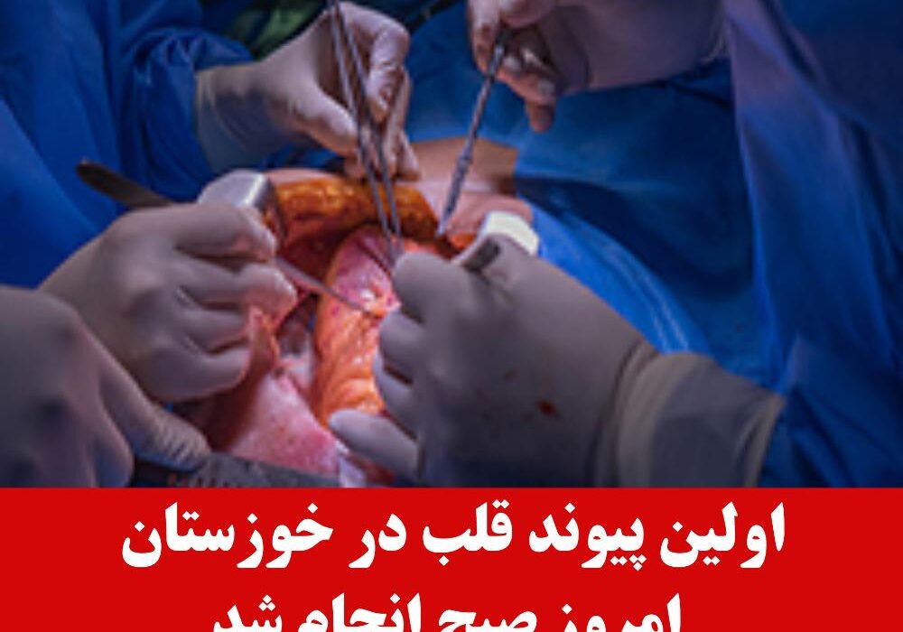 اولین عمل پیوند قلب در خوزستان انجام شد